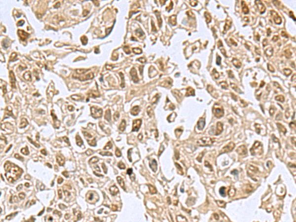 NVL Antibody