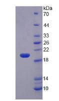 Rat MMP3 Protein (Recombinant His)
