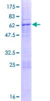 Human LMAN2 / VIP36 Protein (Recombinant GST)