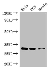 Polyclonal Rabbit anti-Human HOXB13 Antibody (WB)