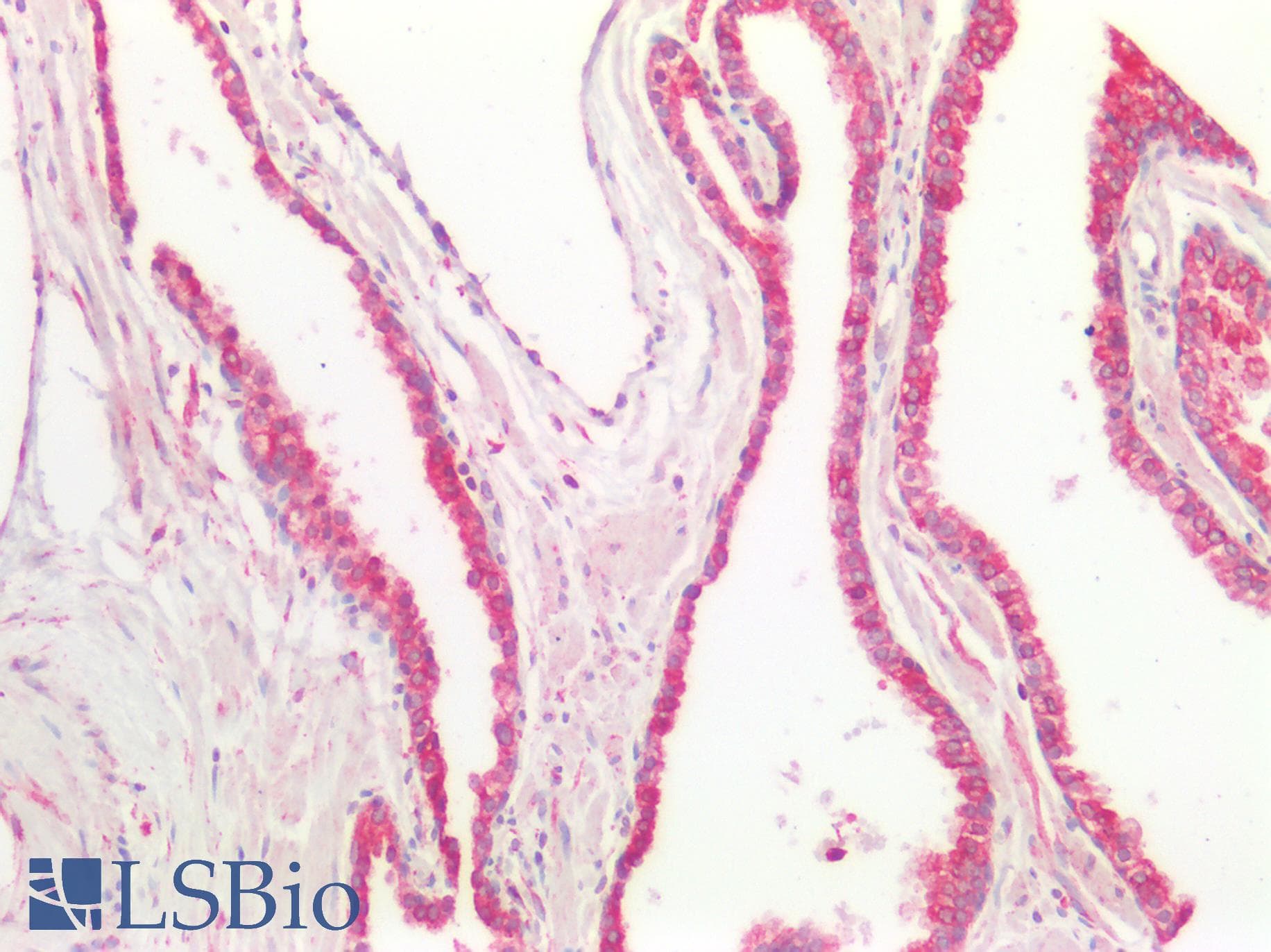 PathPlus™ CD47 Antibody