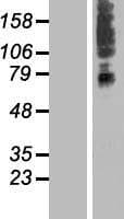 SLC41A3 Protein (Over-Expression Lysate Myc-DDK (Flag))