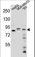 IHC-plus™ Polyclonal Rabbit anti-Human KANSL3 Antibody (aa398-427, IHC, WB)