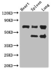 ZKSCAN3 / ZNF306 Antibody