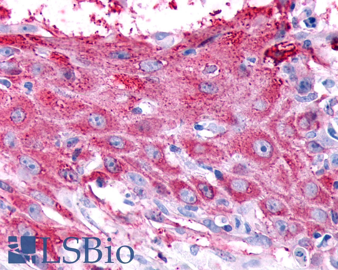 PathPlus™ Polyclonal Rabbit anti-Human RXFP2 / LGR8 Antibody (Cytoplasmic Domain, IHC, WB)