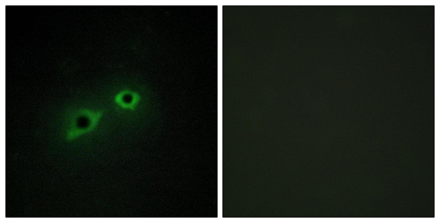 TMPRSS15 / Enterokinase Antibody