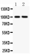 Polyclonal Rabbit anti-Human ITGB2 / CD18 Antibody (aa404-769, IHC, WB)