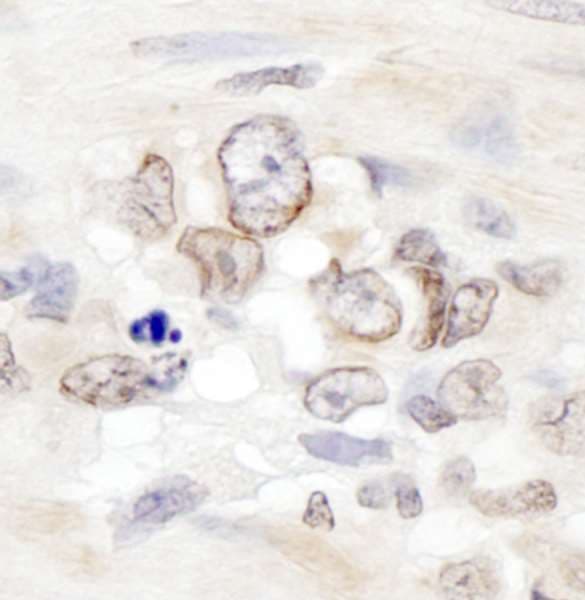 AAAS / Adracalin Antibody (aa496-546)