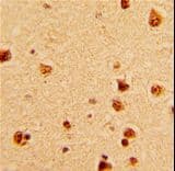 Polyclonal Rabbit anti-Human KHSRP / FBP2 Antibody (aa94-122, IHC, IF, WB)