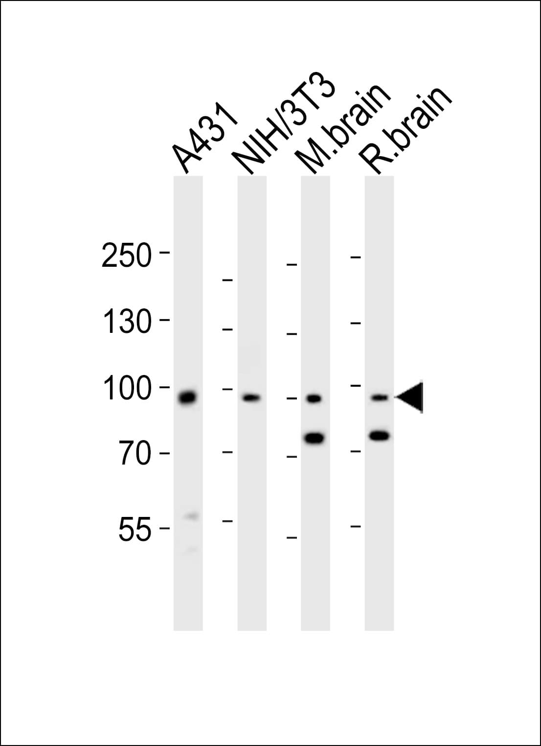 EPHB1 / EPH Receptor B1 Antibody (aa374-409)