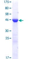 Human EMC9 Protein (Recombinant GST)