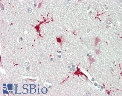 IHC-plus™ KCTD12 Antibody (aa125-175)