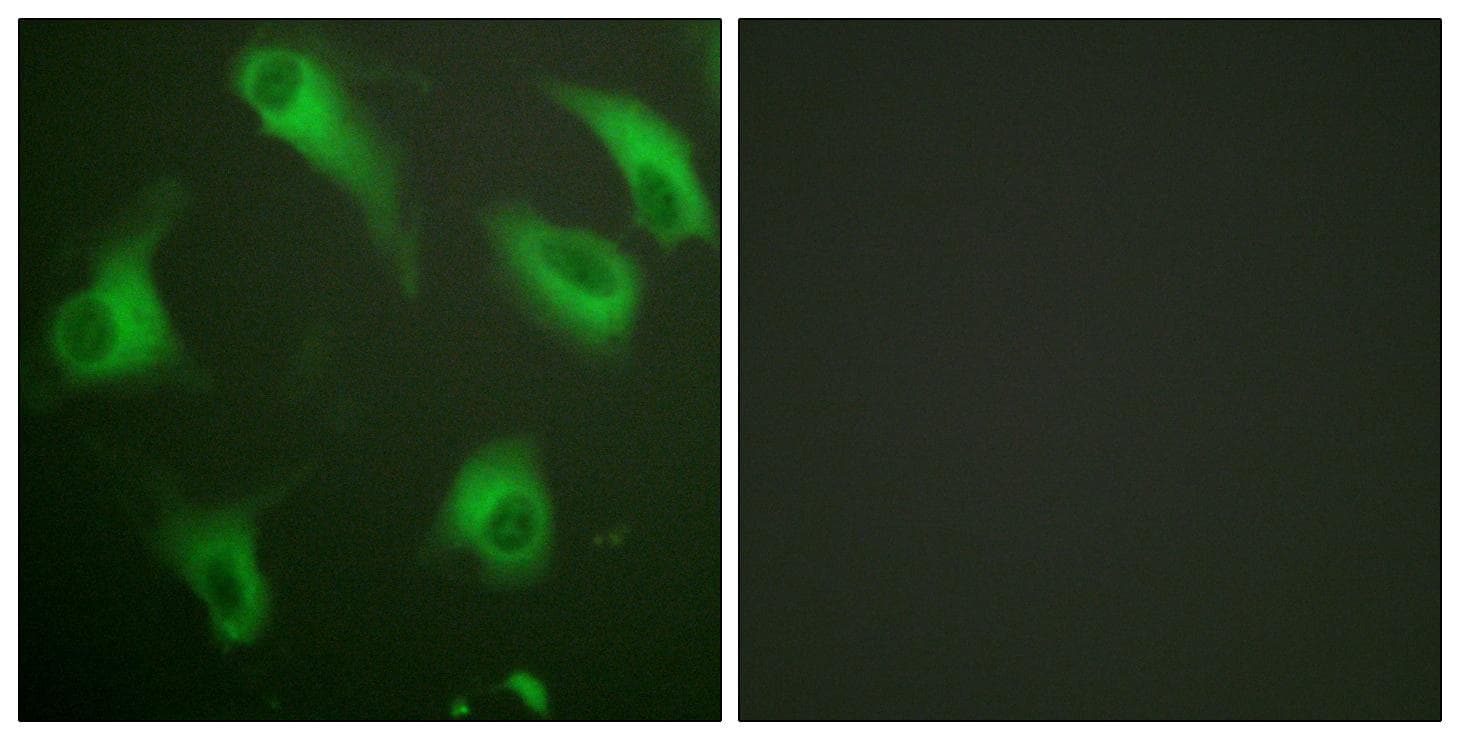 Polyclonal Rabbit anti-Human C5AR1 / CD88 / C5a Receptor Antibody (p338, IHC, IF, WB)