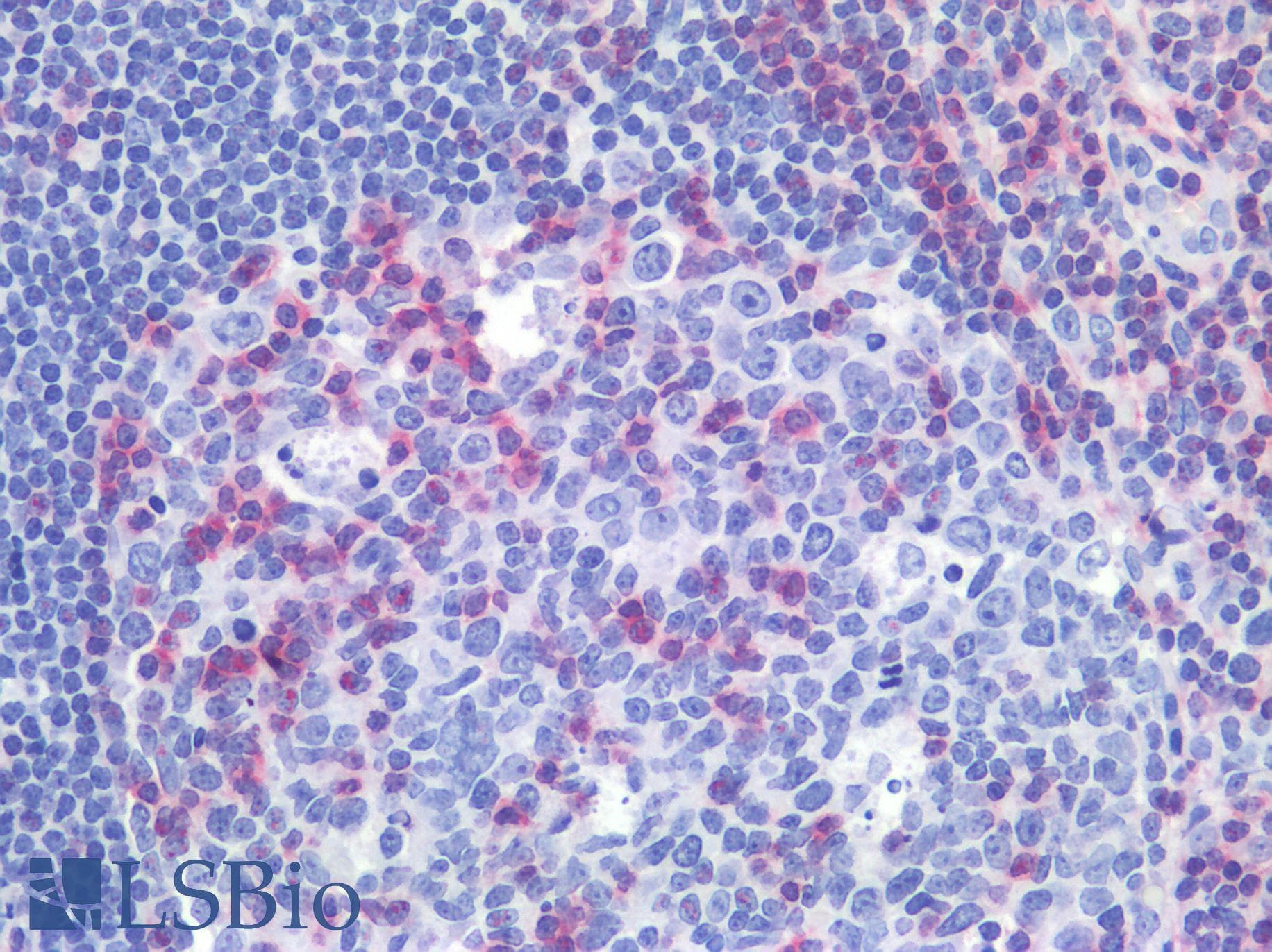PathPlus™ LAT Antibody (Cytoplasmic Domain, clone LAT1111)