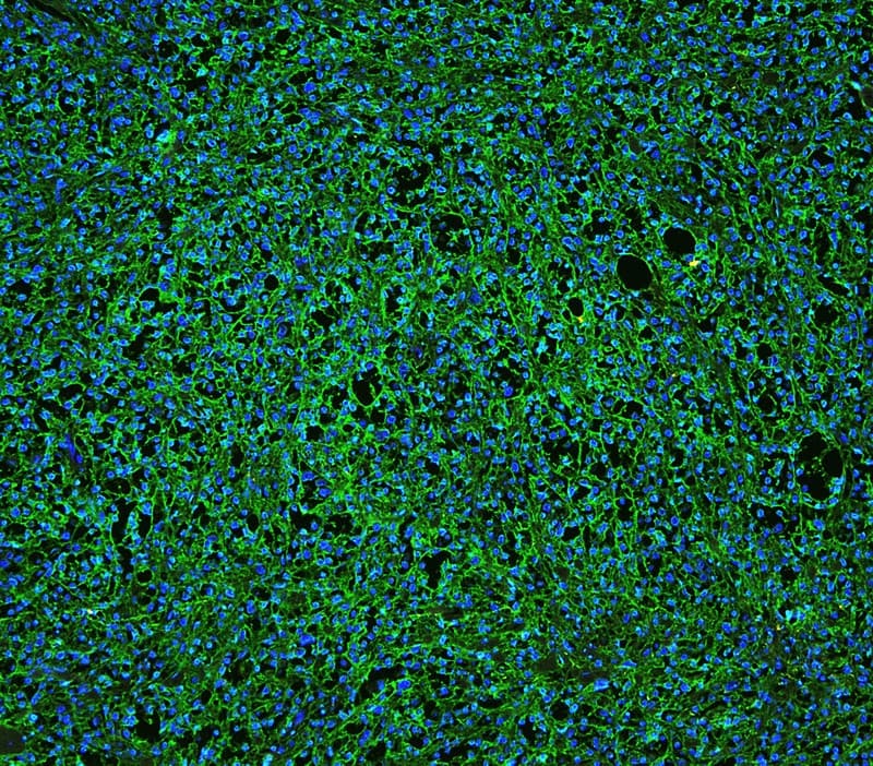 Polyclonal Rabbit anti-Human CD20 Antibody (aa1-261, IHC, WB)