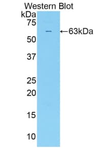SULF2 / Sulfatase 2 Antibody (aa337-649)