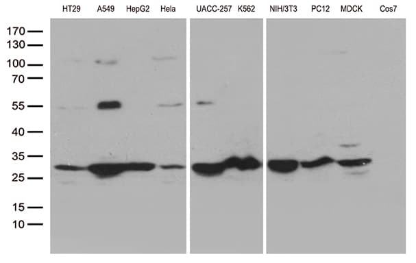SDHB Antibody (clone OTI2A1)