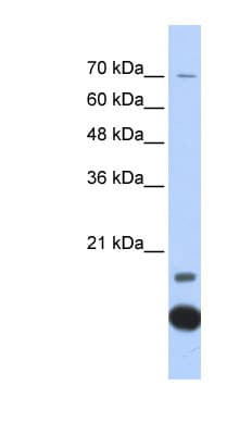 Polyclonal Rabbit anti-Human TXN2 / Thioredoxin 2 Antibody (C-Terminus, IHC, WB)