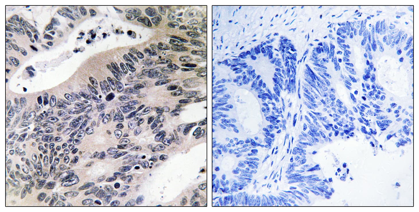 ACSS1 Antibody (aa611-660)