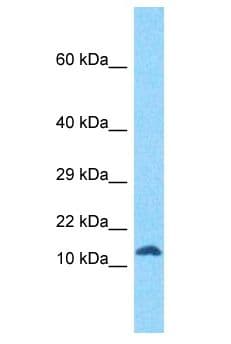 Polyclonal Rabbit anti-Human RIIAD1 Antibody (aa7-56, WB)