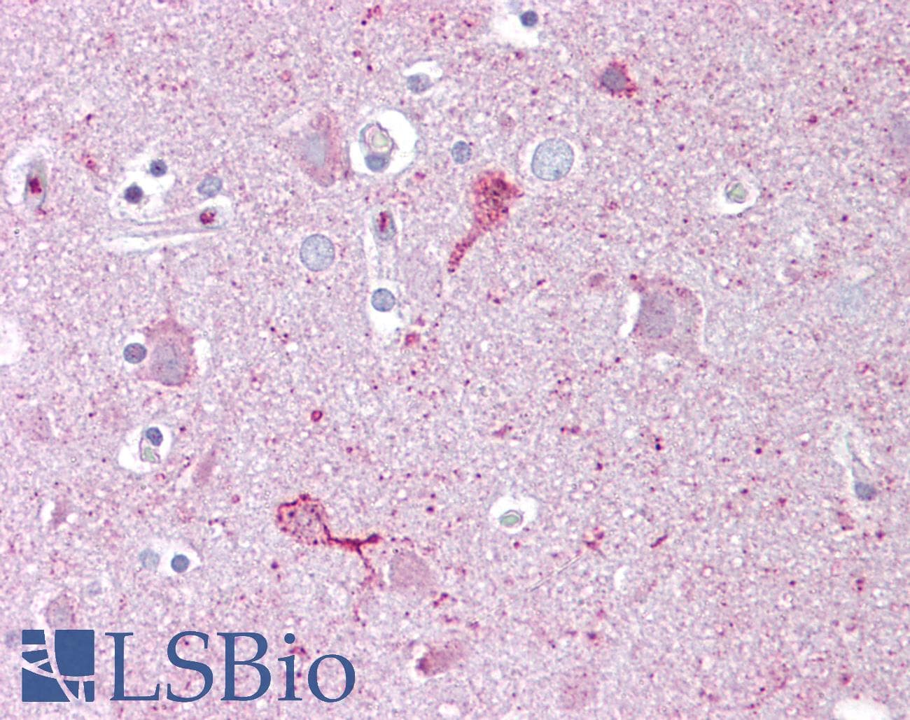 Polyclonal Rabbit anti-Human EGR3 Antibody (C-Terminus, IHC, WB)