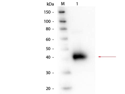 ORM1 / Orosomucoid Antibody (Lyophilized)