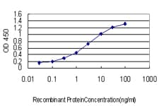 Monoclonal Mouse anti-Human ZMYND8 / RACK7 Antibody (clone 5B12, WB)