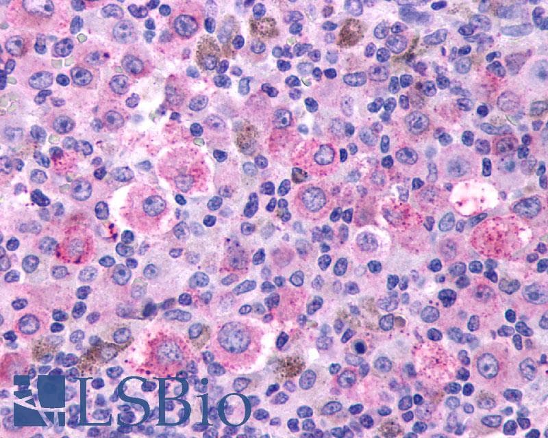 IHC-plus™ Polyclonal Rabbit anti-Human Thromboxane A2 Receptor Antibody (C-Terminus, IHC)