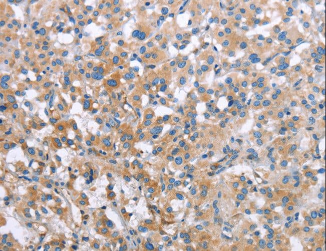 MCL1 / MCL 1 Antibody