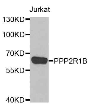 Polyclonal Rabbit anti-Human PPP2R1B Antibody (IHC, WB)