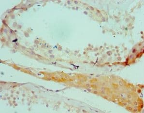 Polyclonal Rabbit anti-Human SALL4 Antibody (aa1-220, IHC)