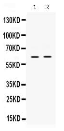 Polyclonal Rabbit anti-Human PAK3 Antibody (aa13-49, IHC, WB)