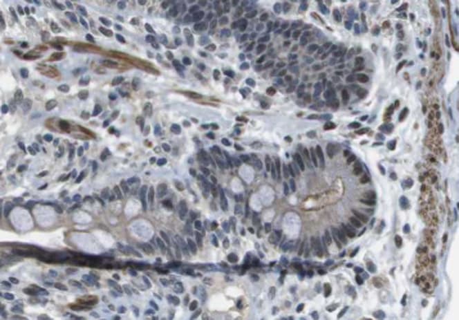 Peripherin Antibody (aa445-470)