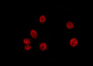 HDAC2 Antibody