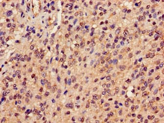 PRDX6 / Peroxiredoxin 6 Antibody
