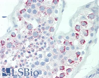 IHC-plus™ ABCB6 Antibody