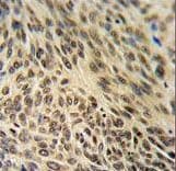 XRCC6 / Ku70 Antibody (aa521-548)