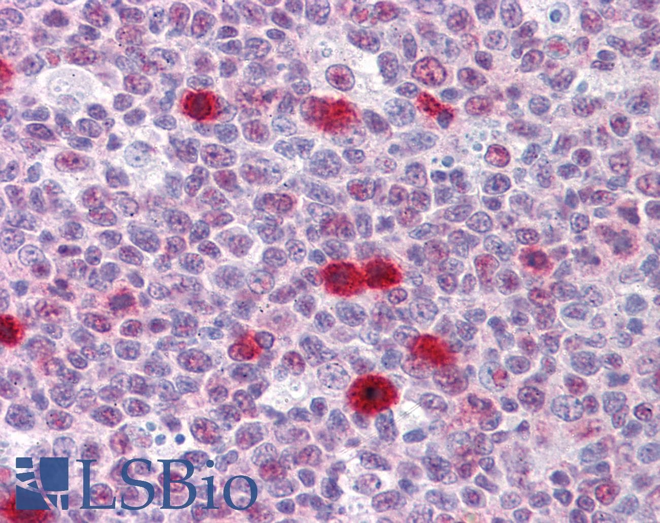 IHC-plus™ Monoclonal Mouse anti-Human TSC22D3 / GILZ Antibody (clone 3A5, IHC, IF, WB)