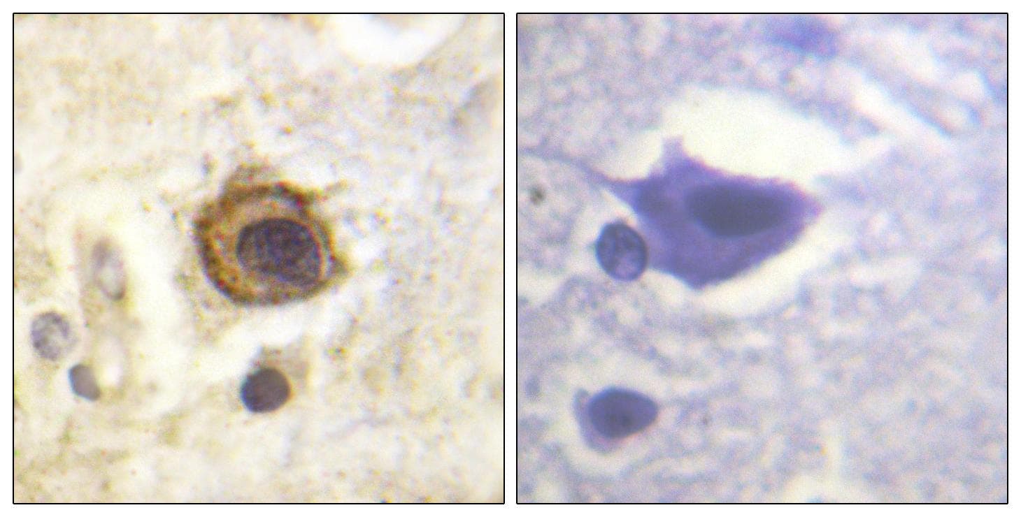 PDGFRB / PDGFR Beta Antibody (p1021)