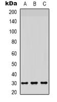 Polyclonal Rabbit anti-Human CD66c / CEACAM6 Antibody (Internal, WB)