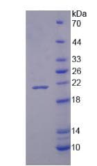 Human NOX4 Protein (Recombinant His)
