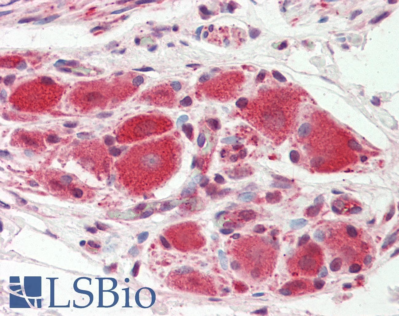 IHC-plus™ KCNJ16 / Kir5.1 Antibody (aa369-418)