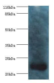 Recoverin Antibody (aa2-200)
