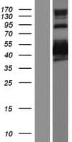 Human SHOOTIN1 / KIAA1598 Protein (Over-Expression Lysate Myc-DDK (Flag))