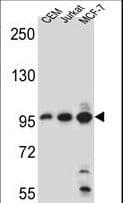 AFTPH Antibody (aa844-871)