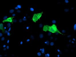 CENPH / CENP-H Antibody (clone OTI2A11)