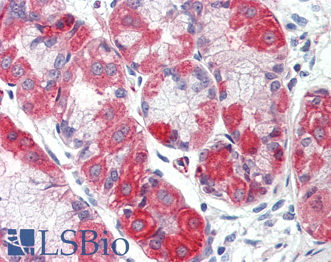 IHC-plus™ SLC12A2 / NKCC1 Antibody (C-Terminus)