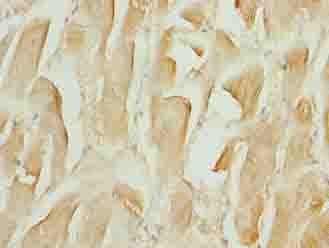 Polyclonal Rabbit anti-Human TMEM184C Antibody (IHC)