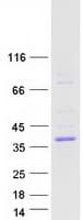 Human ASPHD2 Protein (Recombinant Myc-DDK (Flag))