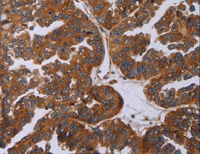 Polyclonal Rabbit anti-Human P2RY2 / P2Y2 Antibody (IHC)